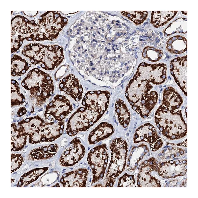 Atlas Antibodies Anti-TCAF2 Antibody