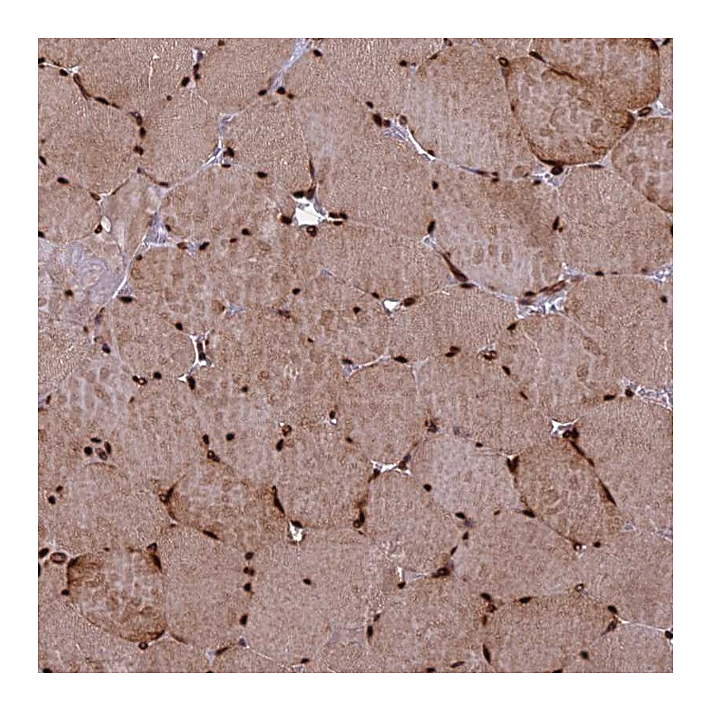 Atlas Antibodies Anti-TCEA3 Antibody