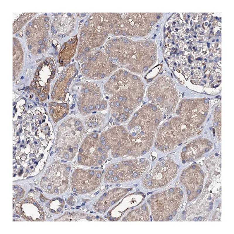 Atlas Antibodies Anti-TCAF2 Antibody