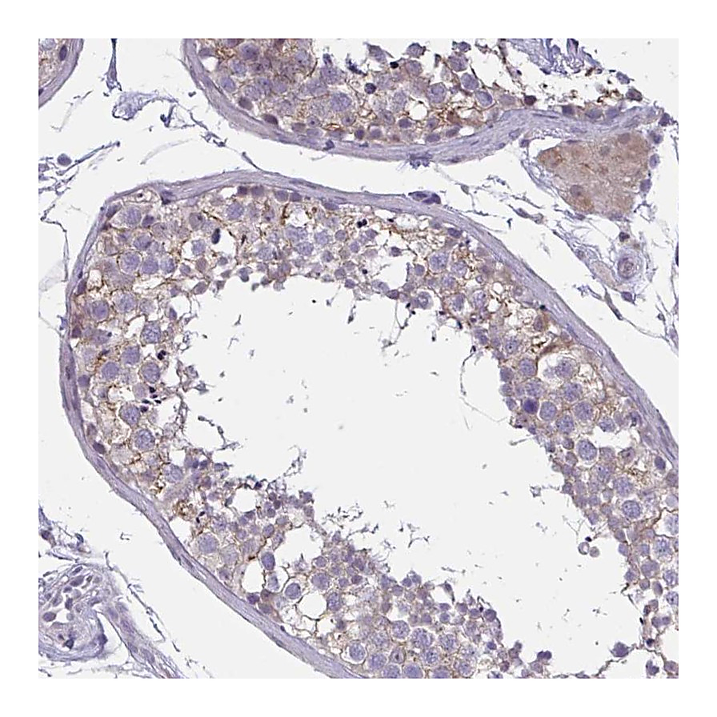 Atlas Antibodies Anti-TCEAL8 Antibody
