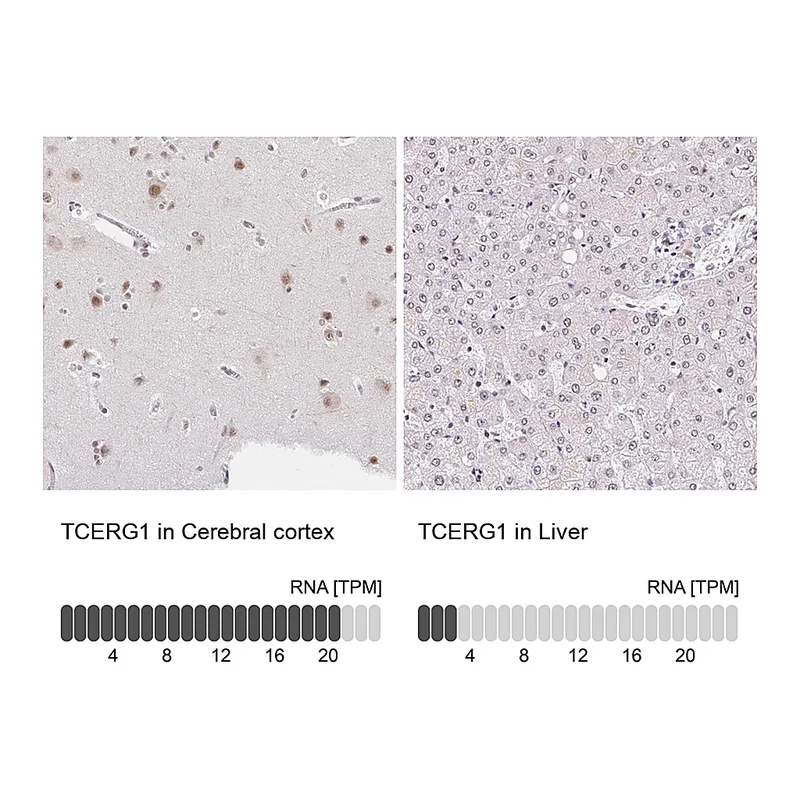 Atlas Antibodies Anti-TCERG1 Antibody