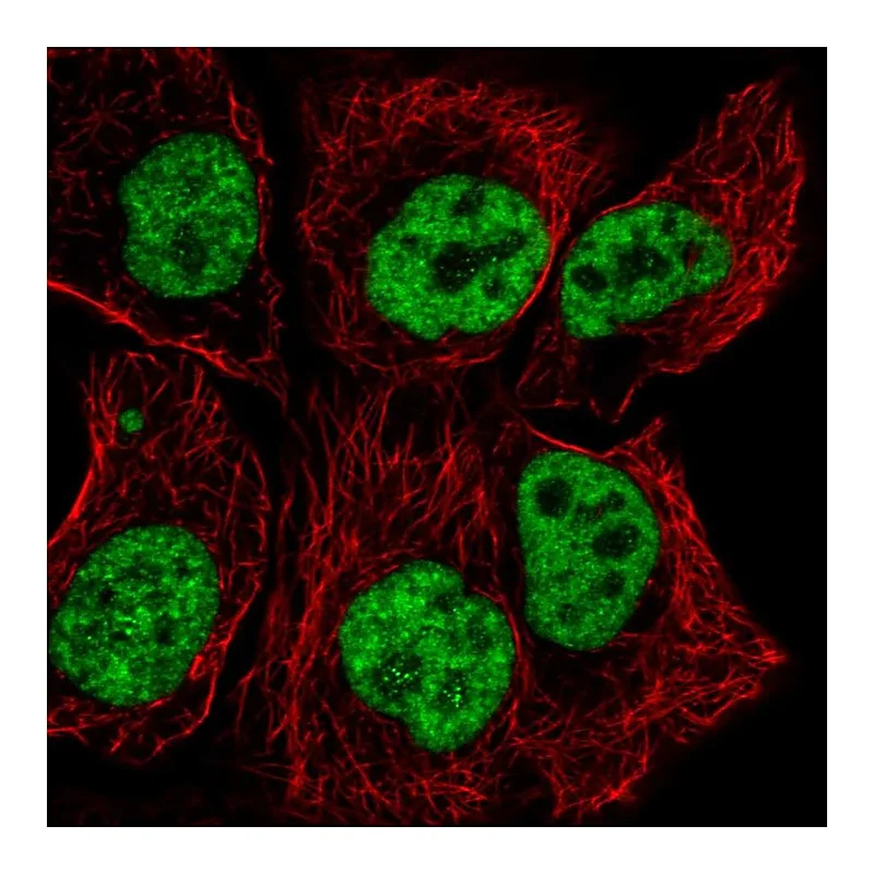 Atlas Antibodies Anti-TCERG1 Antibody