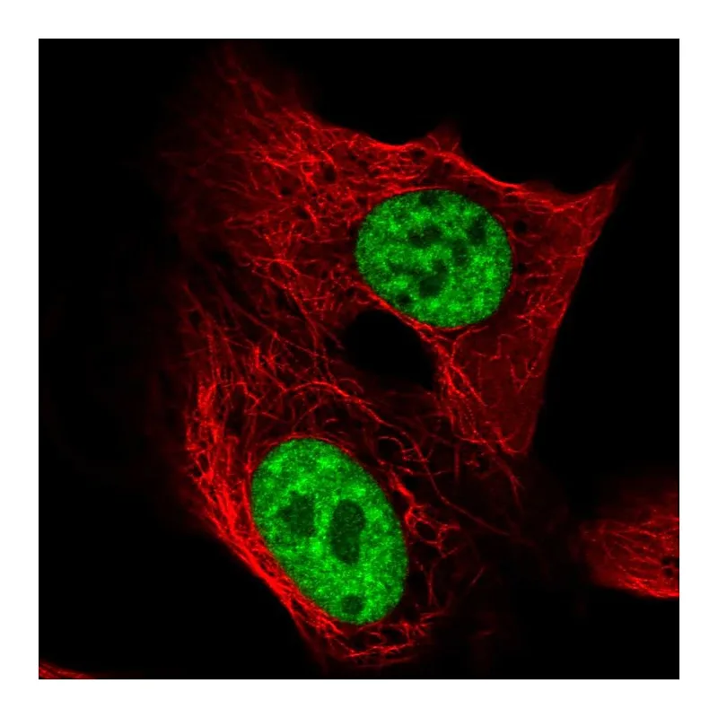 Atlas Antibodies Anti-TCERG1 Antibody