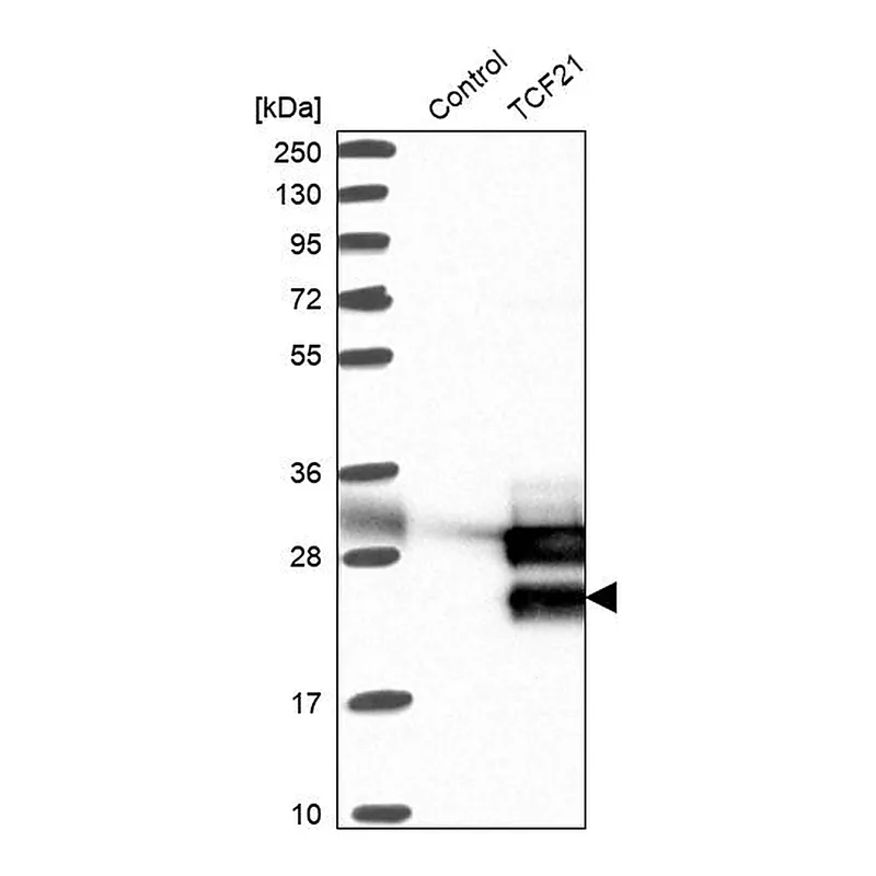 Atlas Antibodies Anti-TCF21 Antibody