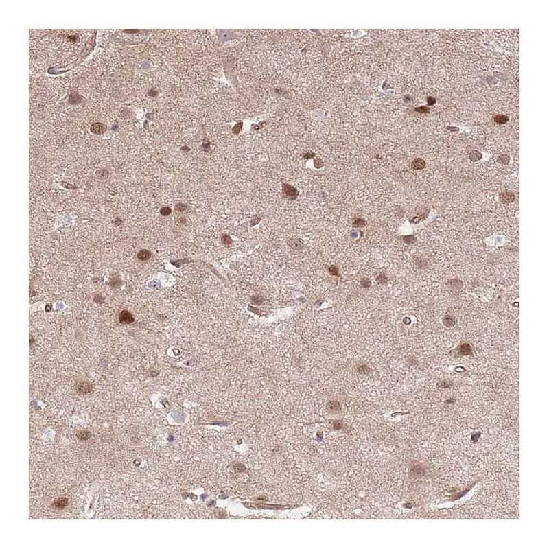 Atlas Antibodies Anti-TCF20 Antibody