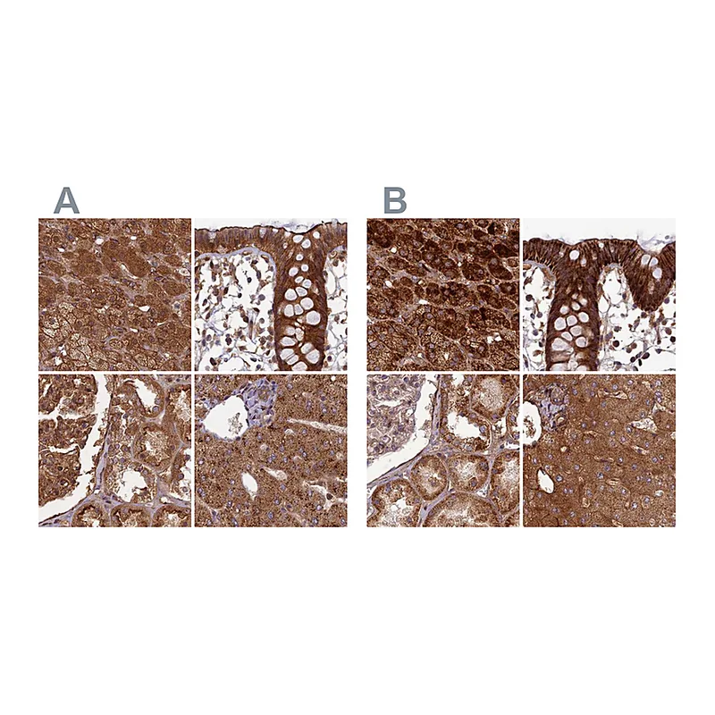 Atlas Antibodies Anti-TCF25 Antibody
