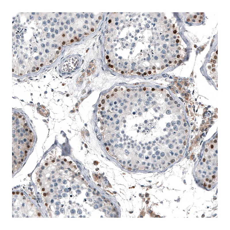 Atlas Antibodies Anti-TCF3 Antibody