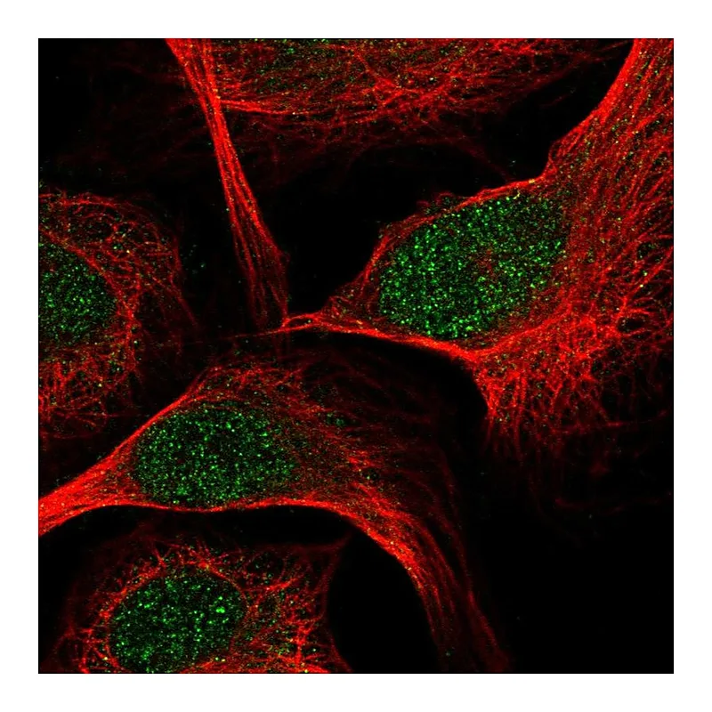 Atlas Antibodies Anti-TCF7 Antibody
