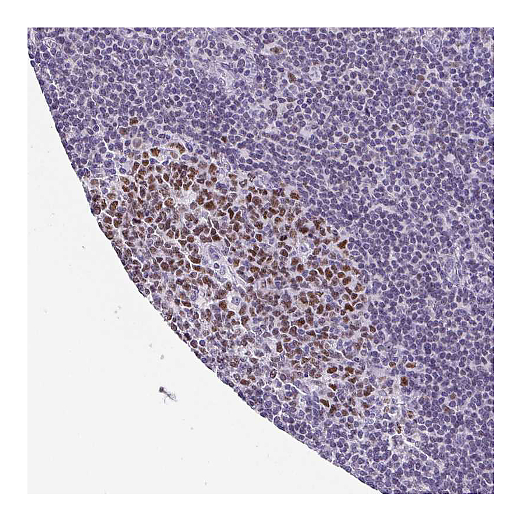 Atlas Antibodies Anti-TCF3 Antibody