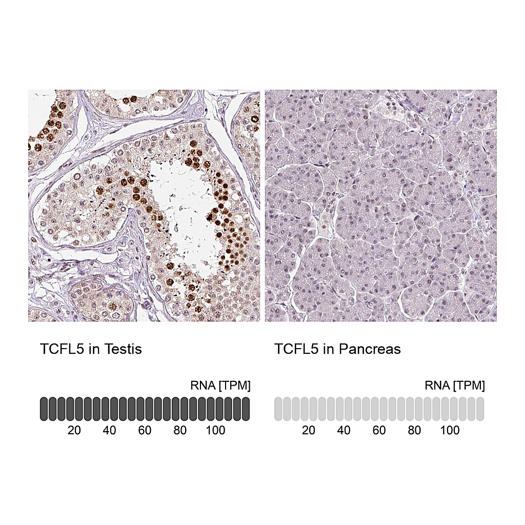 Atlas Antibodies Anti-TCFL5 Antibody