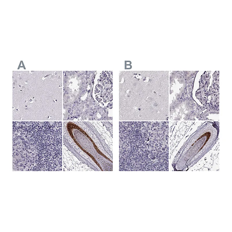 Atlas Antibodies Anti-TCHHL1 Antibody