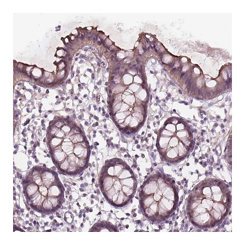 Atlas Antibodies Anti-TCHP Antibody