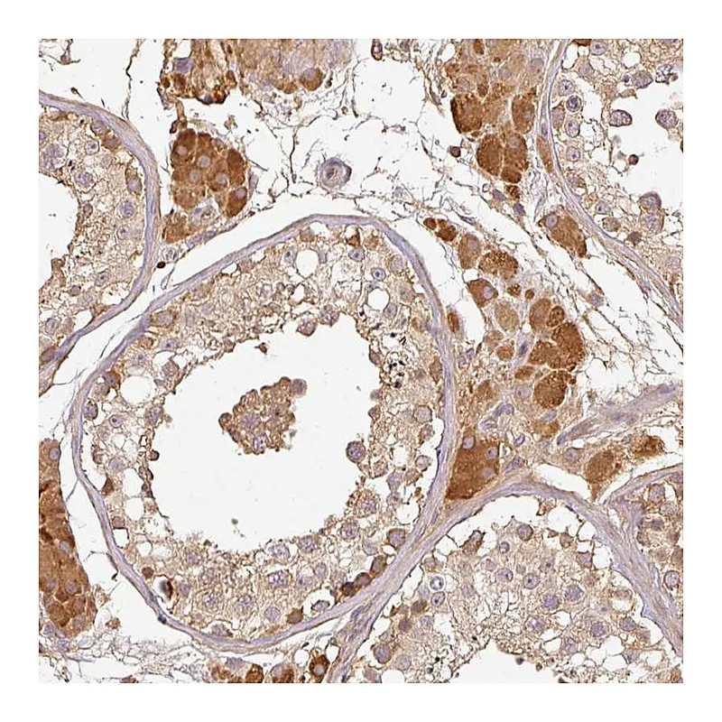 Atlas Antibodies Anti-TCL1B Antibody
