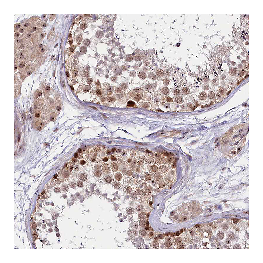 Atlas Antibodies Anti-TCOF1 Antibody
