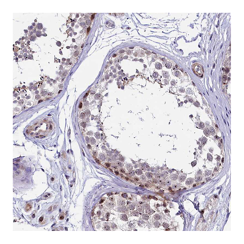 Atlas Antibodies Anti-TCOF1 Antibody
