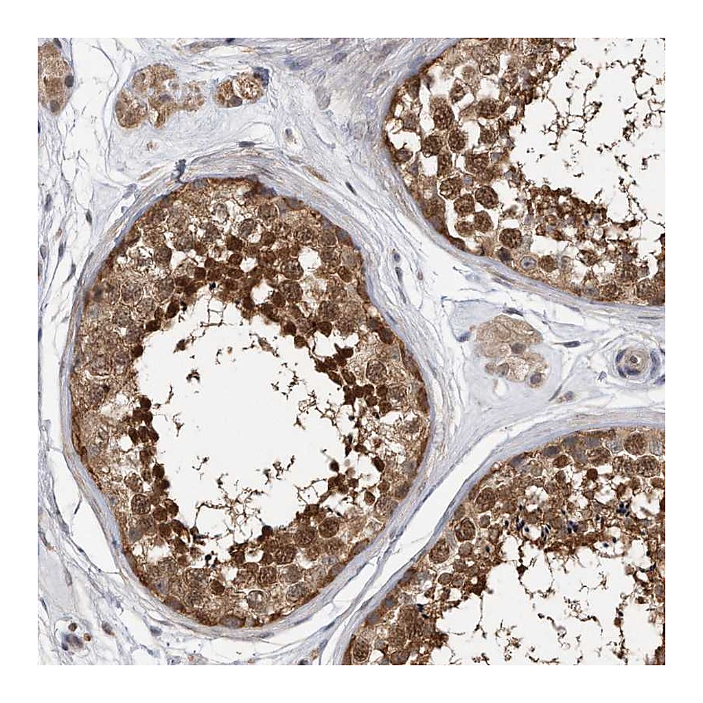 Atlas Antibodies Anti-TCP1 Antibody