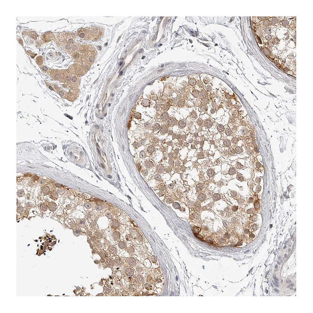 Atlas Antibodies Anti-TCP1 Antibody