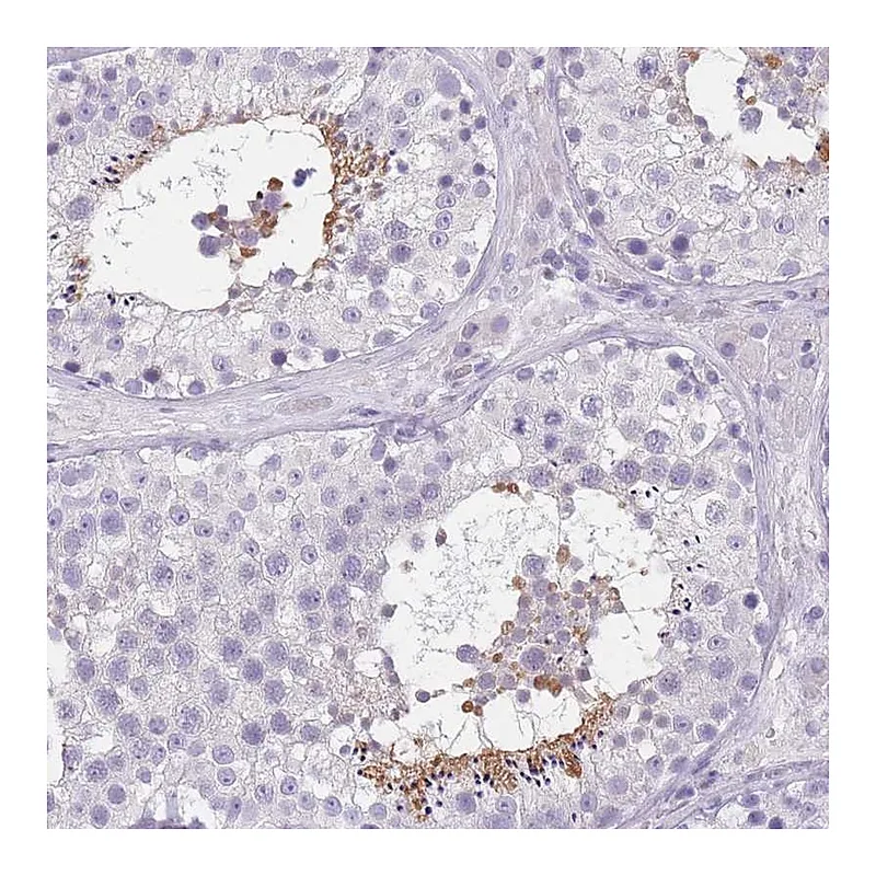 Atlas Antibodies Anti-TCP11 Antibody