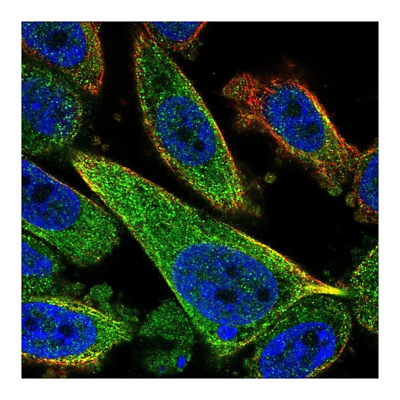 Atlas Antibodies Anti-TCTEX1D2 Antibody