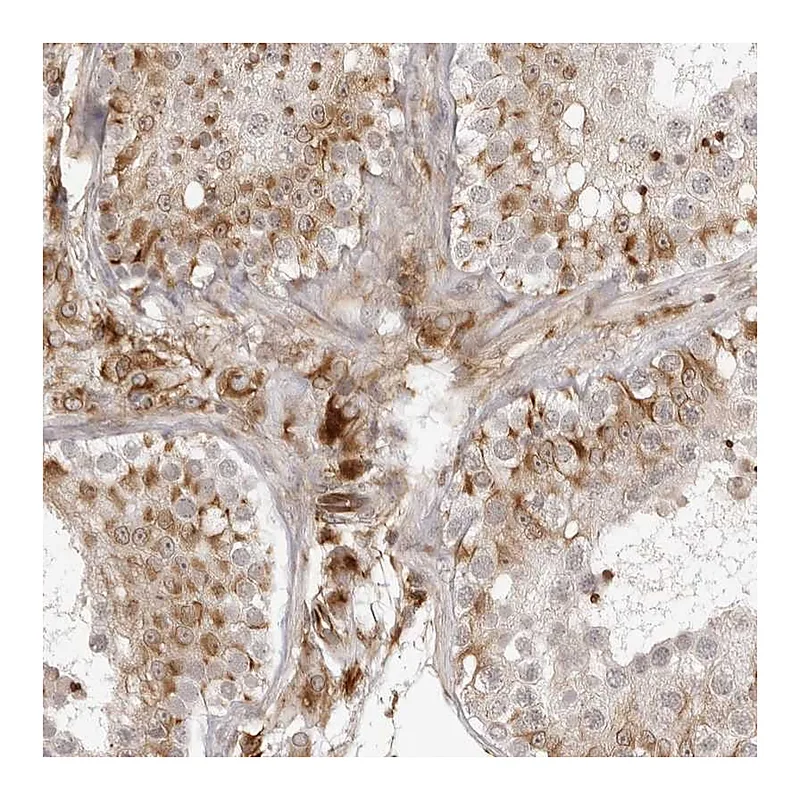 Atlas Antibodies Anti-TCTEX1D1 Antibody