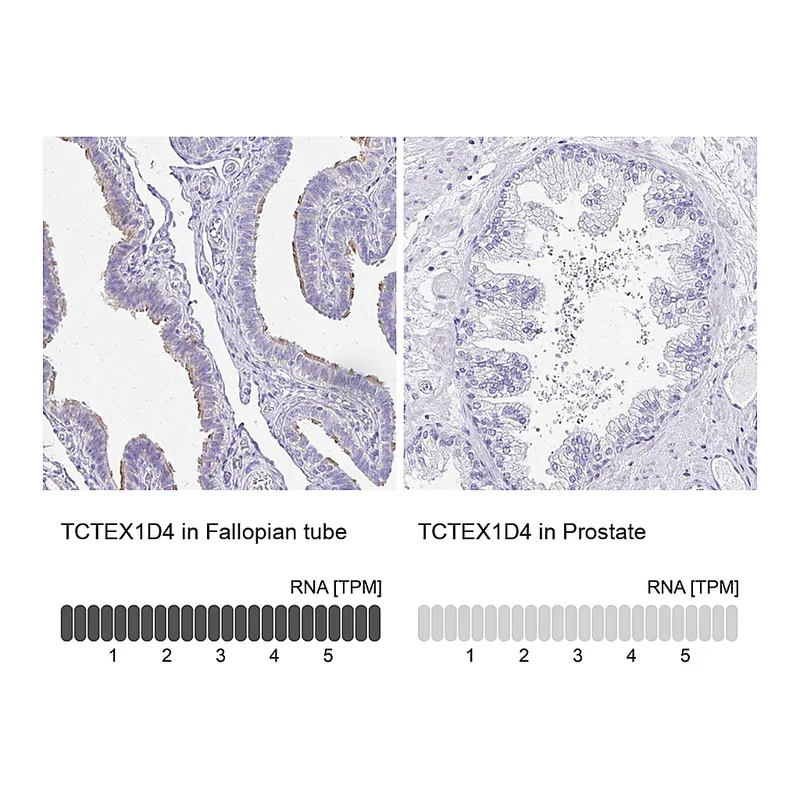 Atlas Antibodies Anti-TCTEX1D4 Antibody