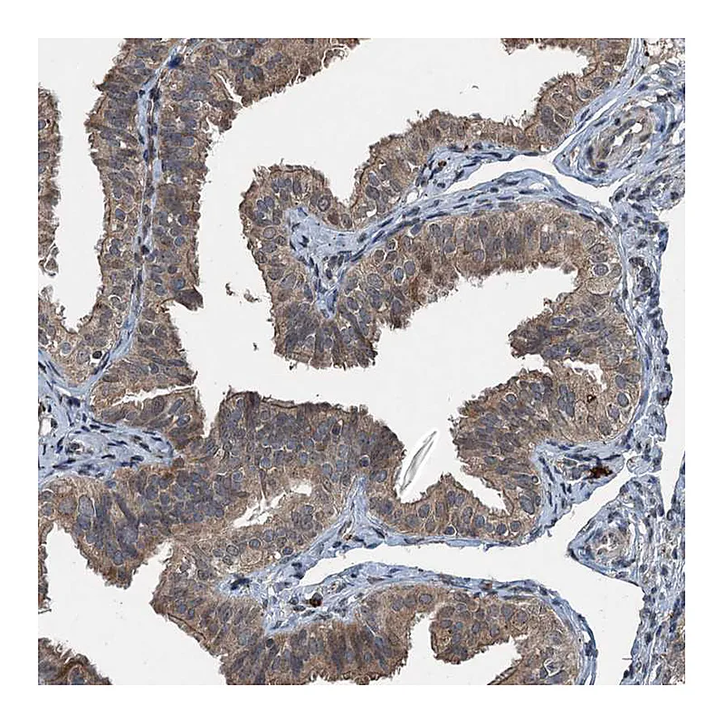 Atlas Antibodies Anti-TCTN1 Antibody