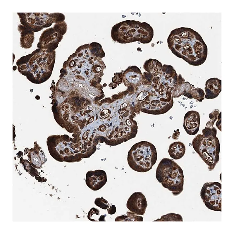 Atlas Antibodies Anti-TCTN1 Antibody