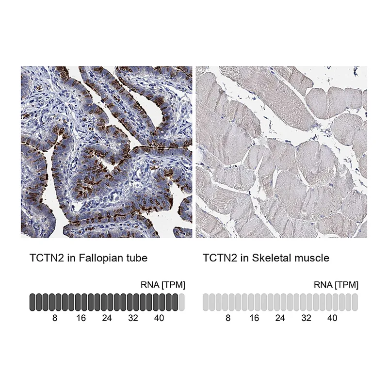 Atlas Antibodies Anti-TCTN2 Antibody