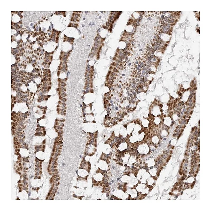 Atlas Antibodies Anti-TCTN3 Antibody
