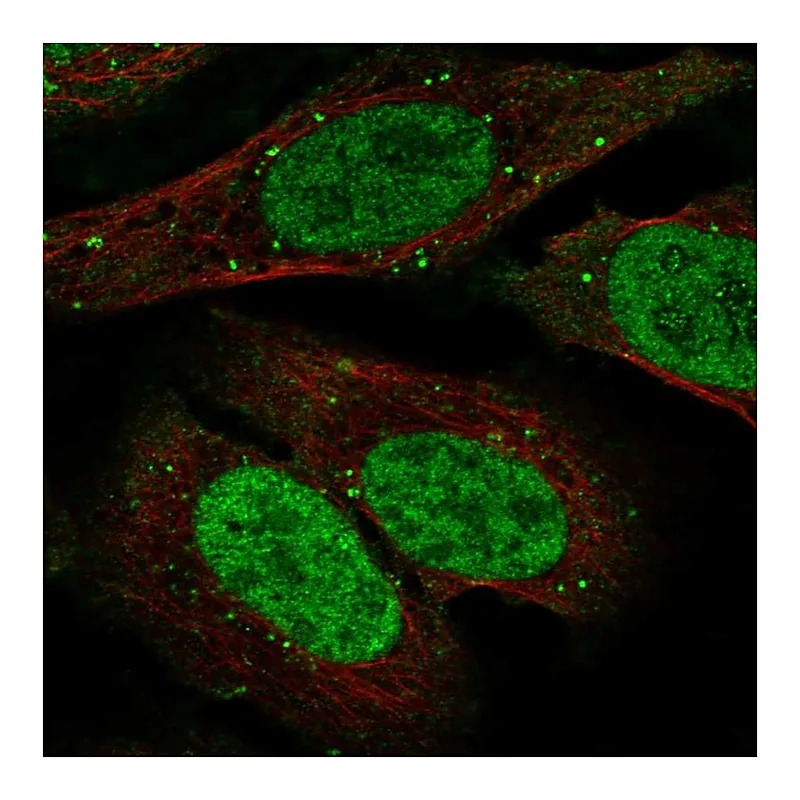 Atlas Antibodies Anti-TDP1 Antibody