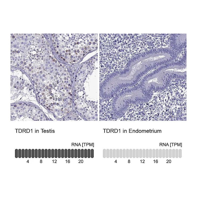 Atlas Antibodies Anti-TDRD1 Antibody