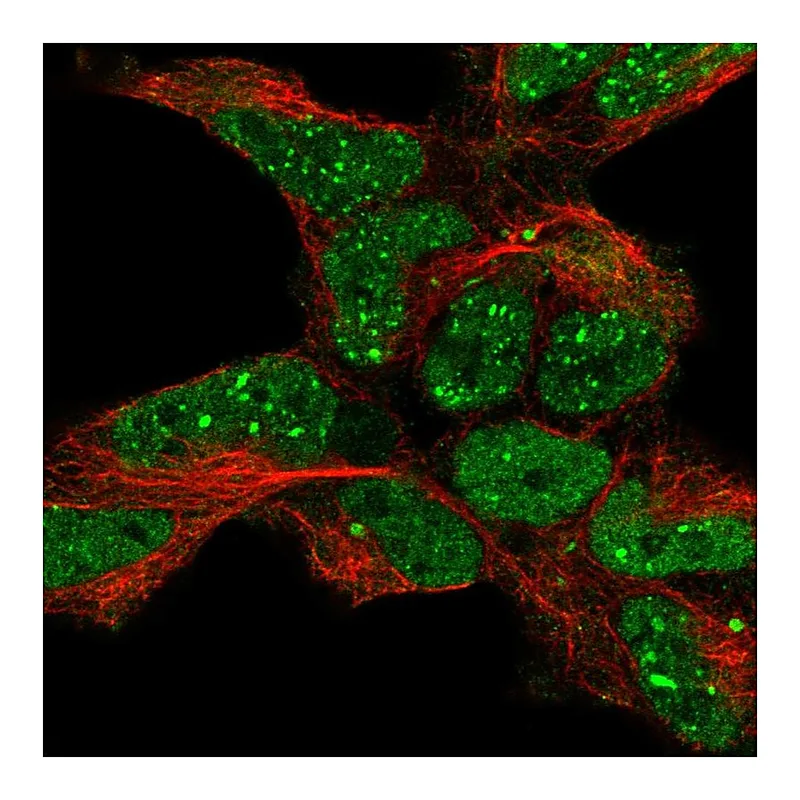Atlas Antibodies Anti-TDP2 Antibody