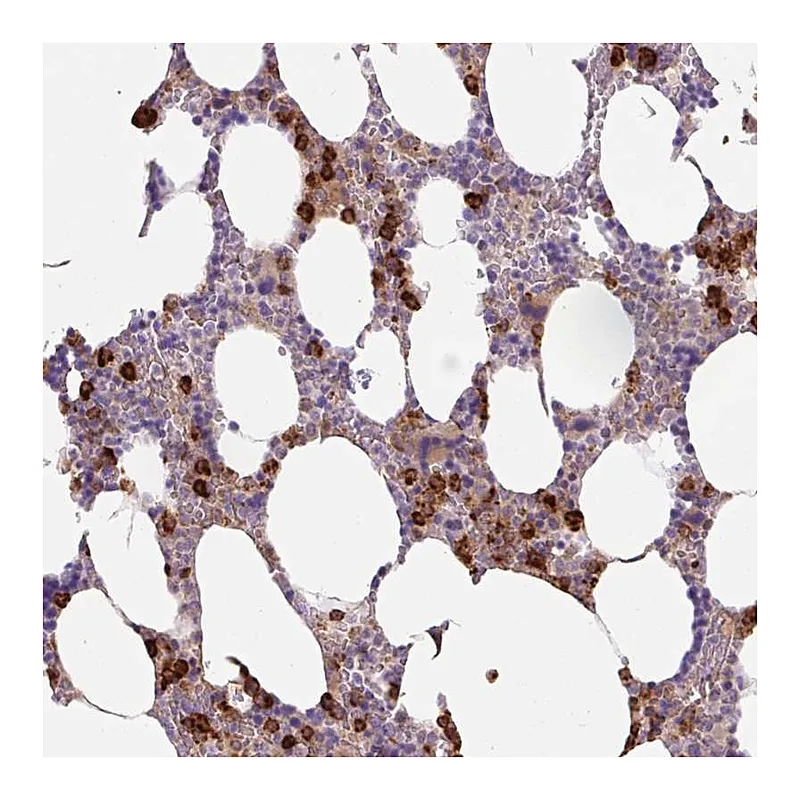Atlas Antibodies Anti-TDRD15 Antibody