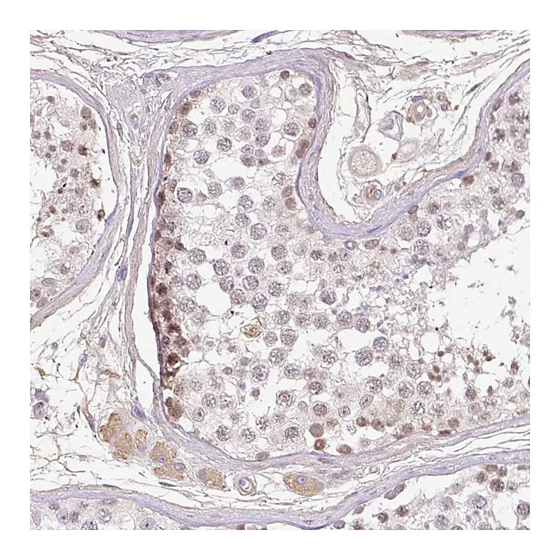 Atlas Antibodies Anti-TDRD15 Antibody