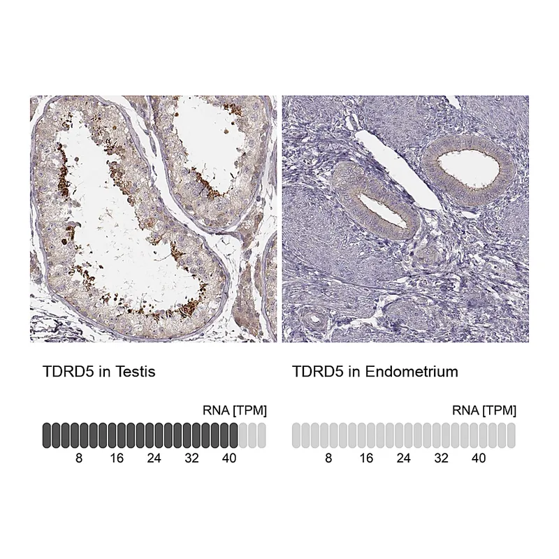Atlas Antibodies Anti-TDRD5 Antibody