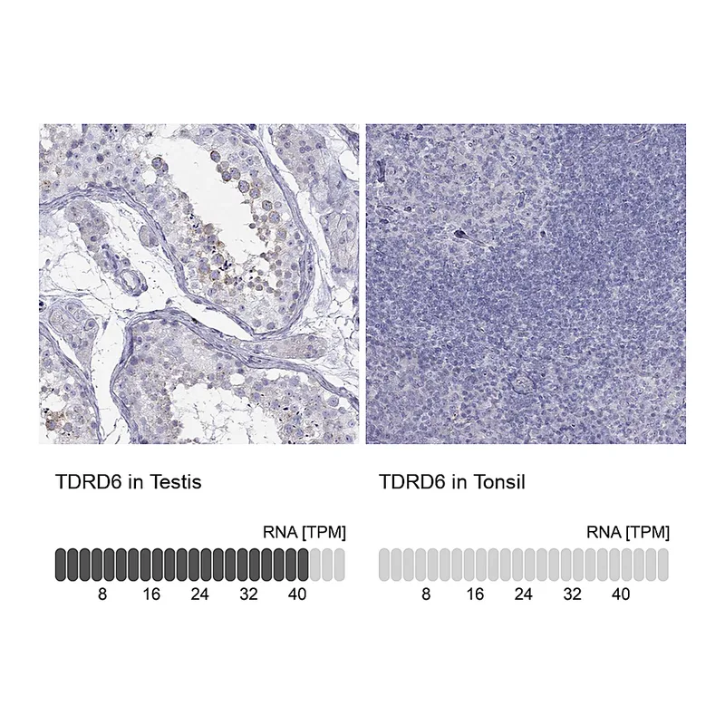 Atlas Antibodies Anti-TDRD6 Antibody