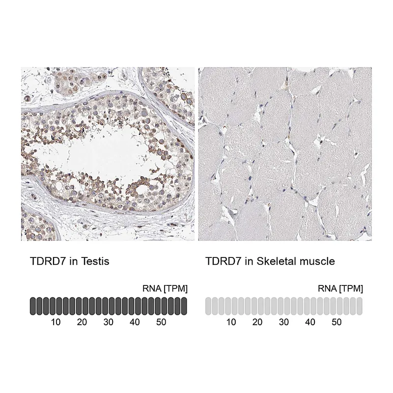 Atlas Antibodies Anti-TDRD7 Antibody