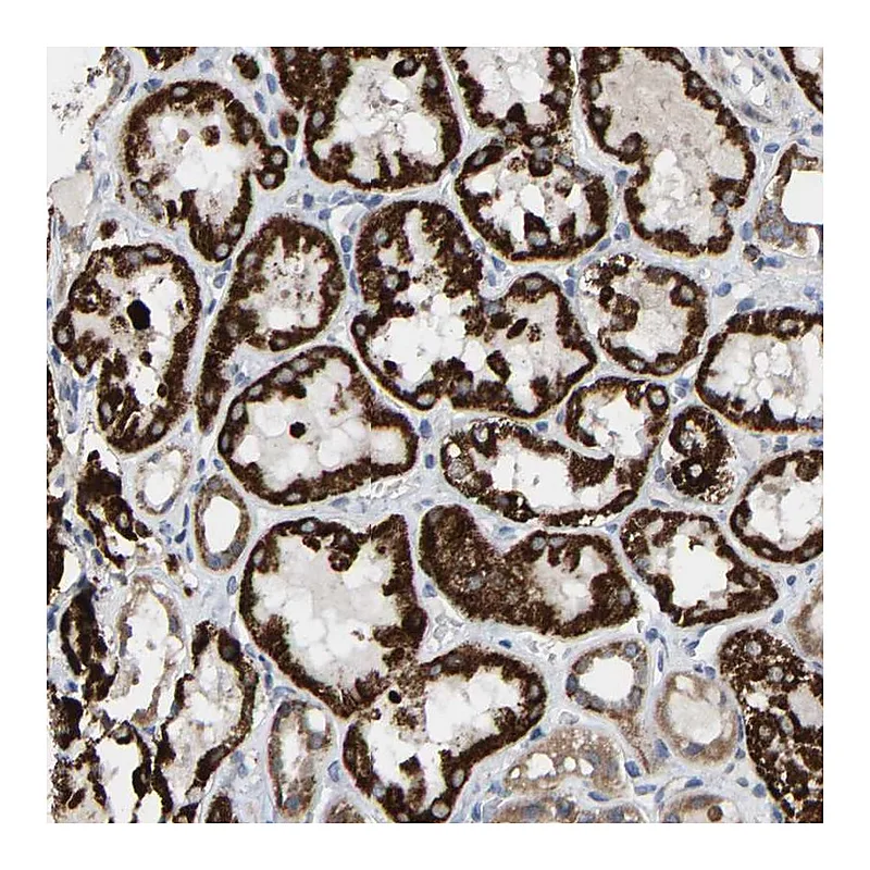 Atlas Antibodies Anti-TDRKH Antibody