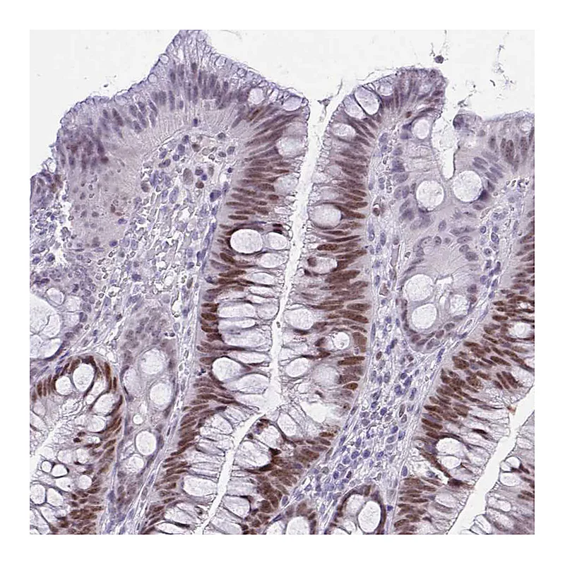 Atlas Antibodies Anti-TEAD4 Antibody
