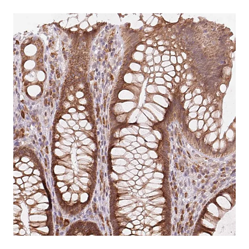 Atlas Antibodies Anti-TECR Antibody