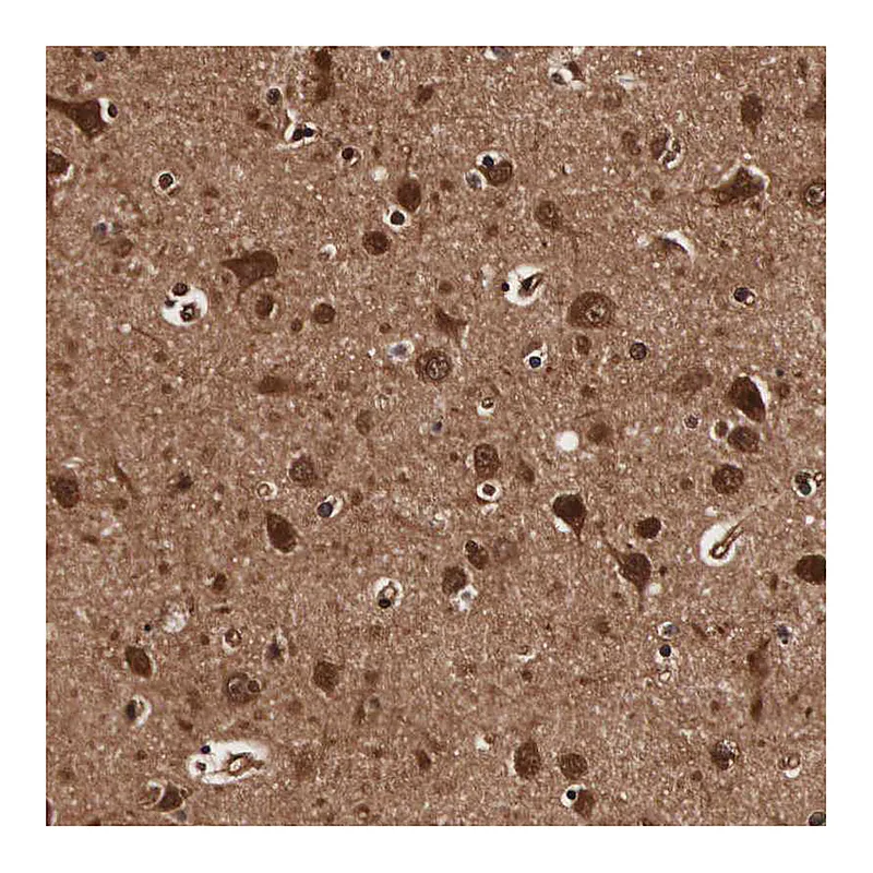 Atlas Antibodies Anti-TECPR2 Antibody