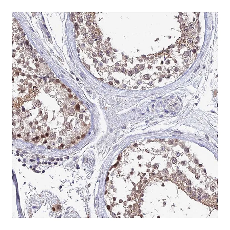 Atlas Antibodies Anti-TEKT1 Antibody