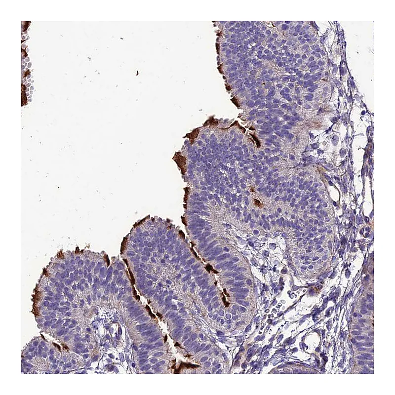 Atlas Antibodies Anti-TEKT3 Antibody