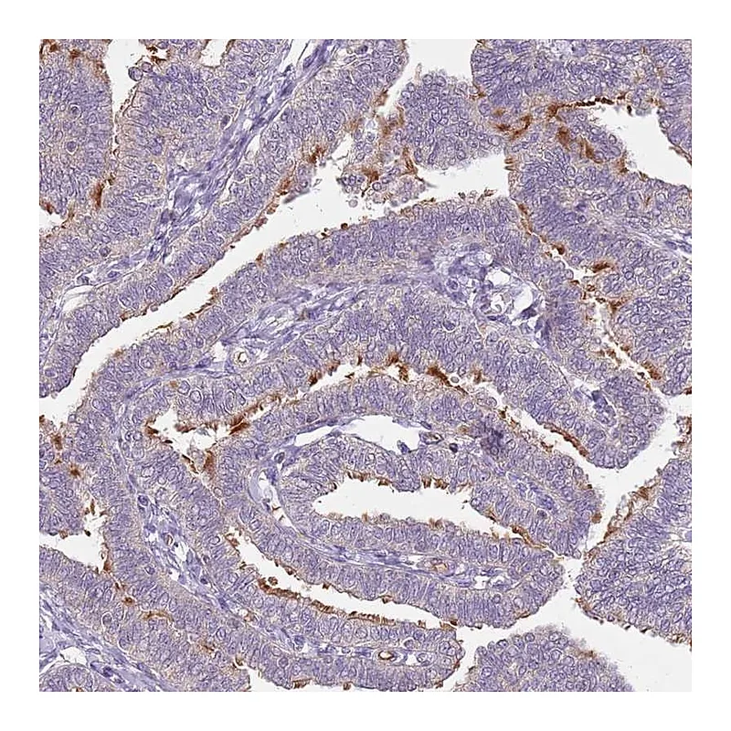 Atlas Antibodies Anti-TEKT4 Antibody