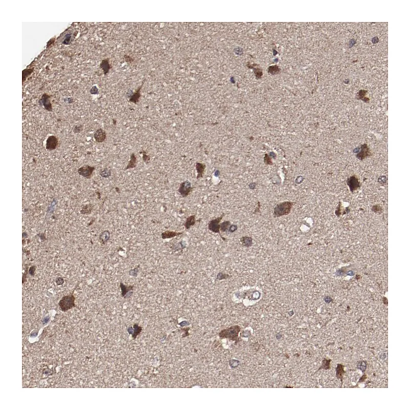Atlas Antibodies Anti-TENM1 Antibody