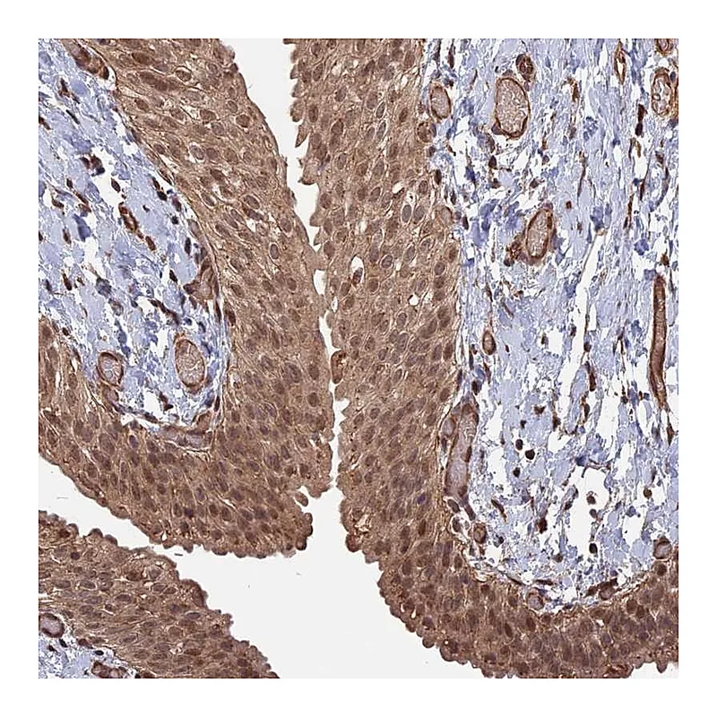 Atlas Antibodies Anti-TELO2 Antibody