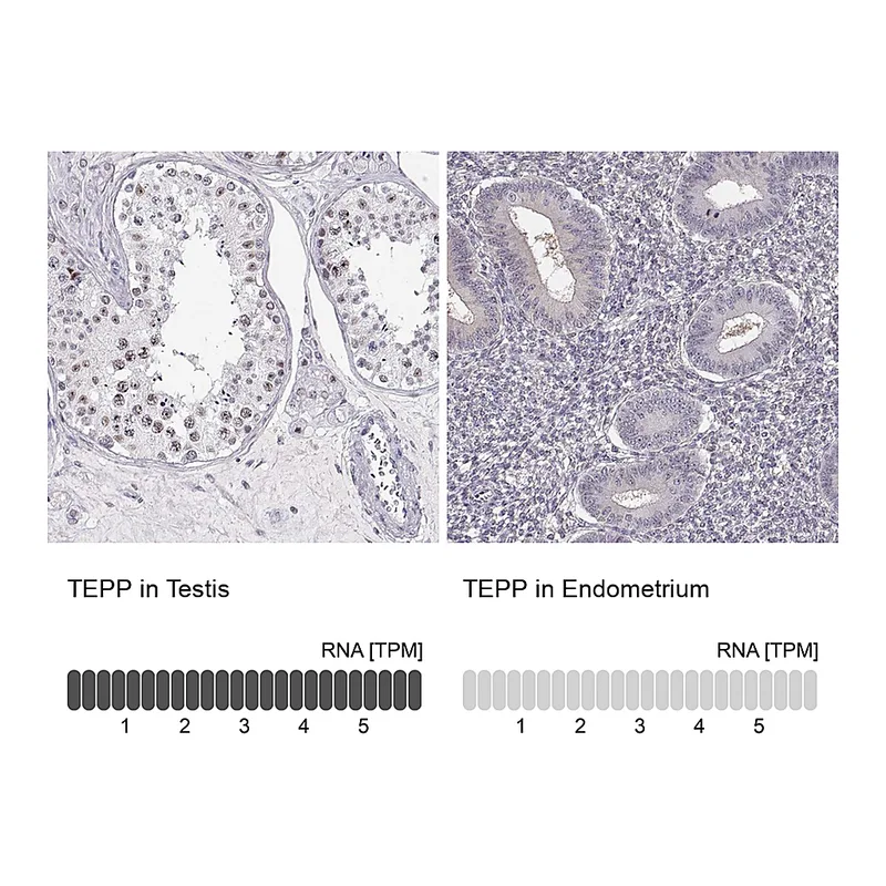 Atlas Antibodies Anti-TEPP Antibody