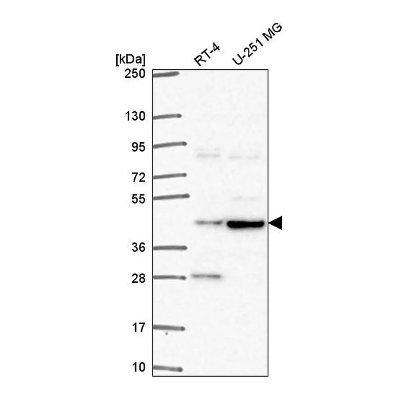 Atlas Antibodies Anti-TEPSIN Antibody