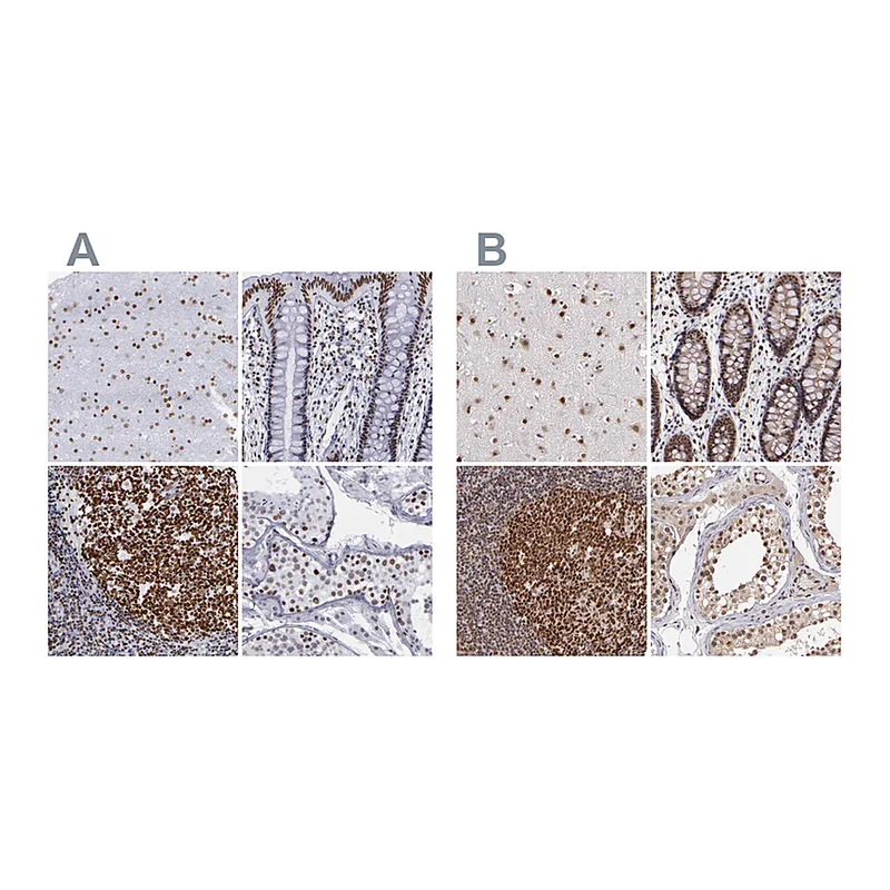 Atlas Antibodies Anti-TERF2 Antibody