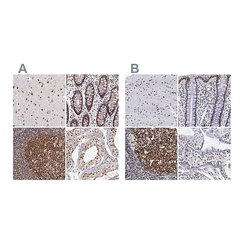 Atlas Antibodies Anti-TERF2 Antibody